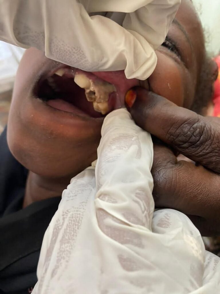 #Santé : Abéché au cœur d’une vaste opération de santé bucco-dentaire